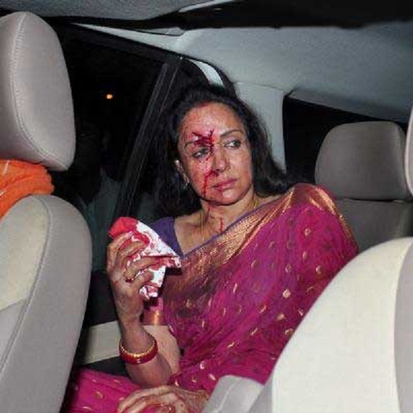 Hema Malini severely injured in road accident
